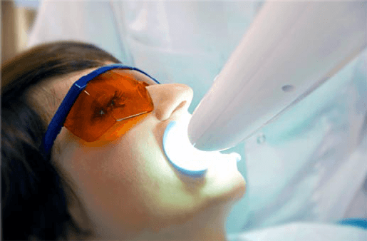 Understanding the Causes of Teeth Sensitivity Purley