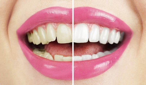 What Early Signs of Oral Cancer Should You Never Ignore Purley?