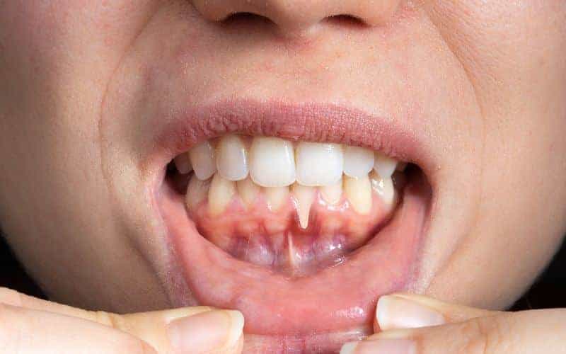 Final Thoughts: Building Lifelong Enamel Protection Habits Purley