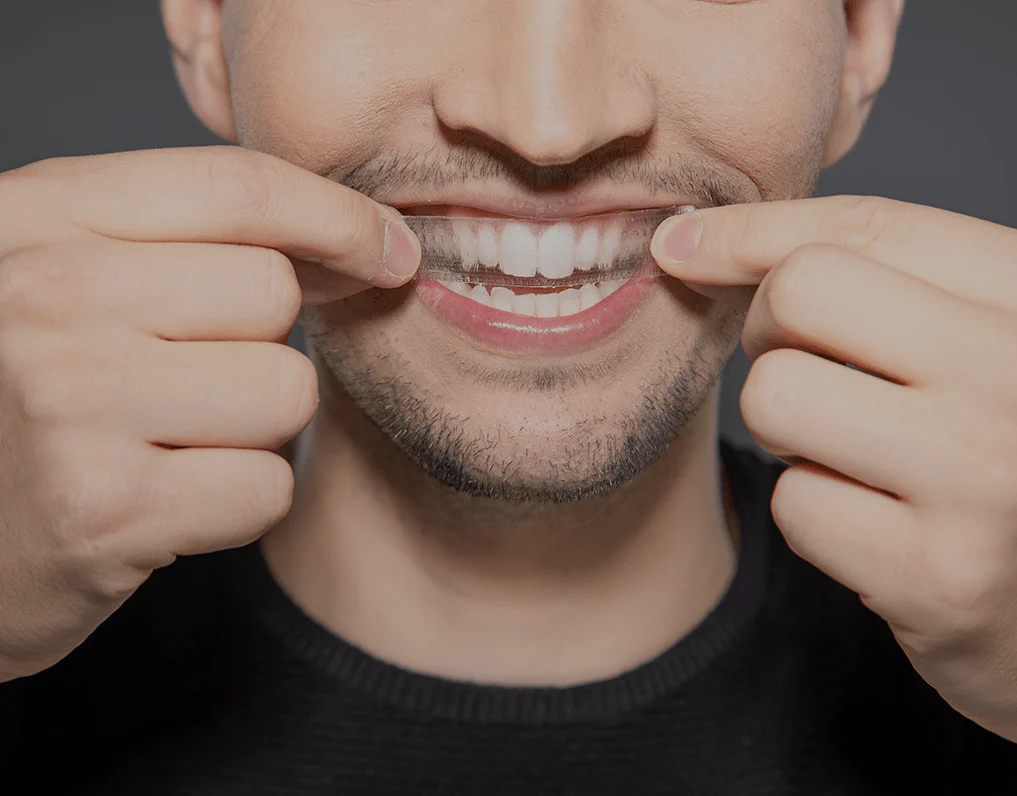 Can You Whiten Natural Teeth Without Harsh Chemicals Purley?