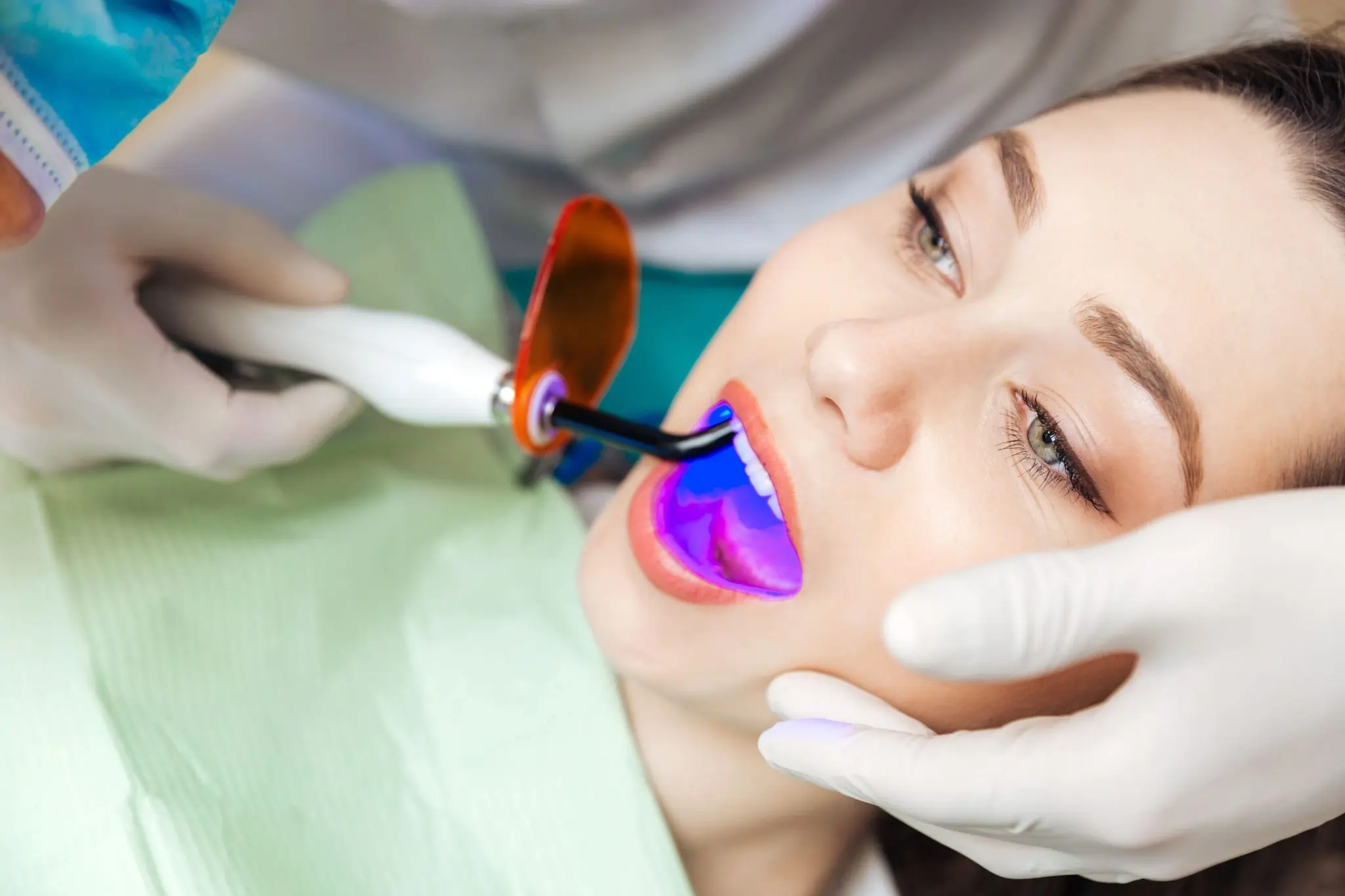 What You Need to Know Before Brightening Your Smile Purley