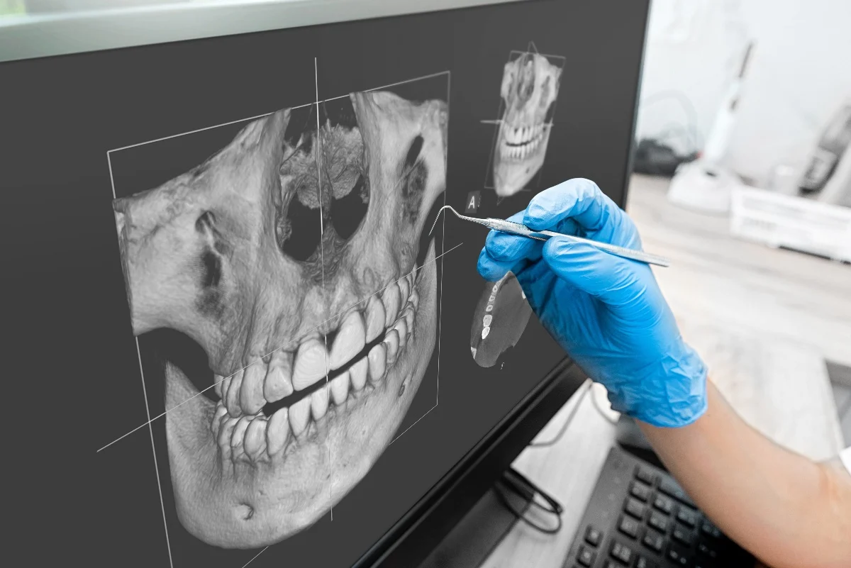 Key Benefits of 3D Printing for Patients and Dentists Purley