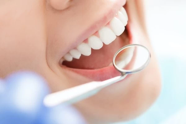 How Much Fluoride Do You Really Need Purley?