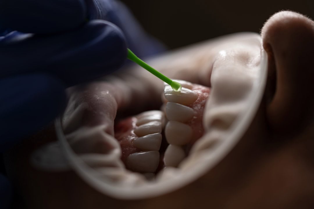 Common Causes of Persistent Dry Mouth Purley