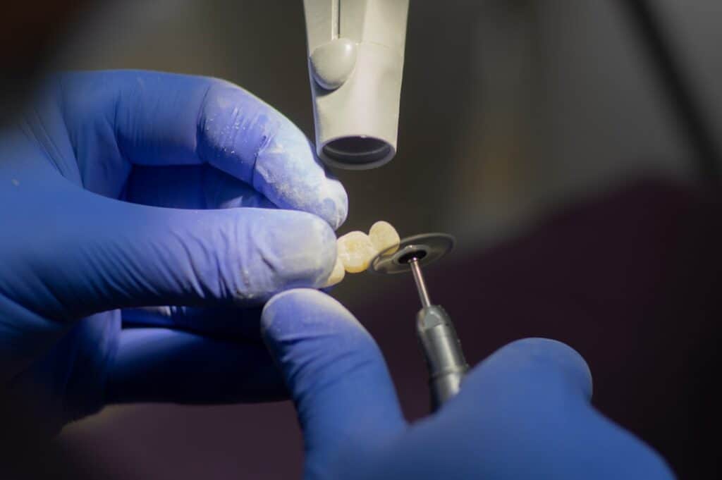Customised Dental Solutions: Crowns, Aligners, and Implants Purley