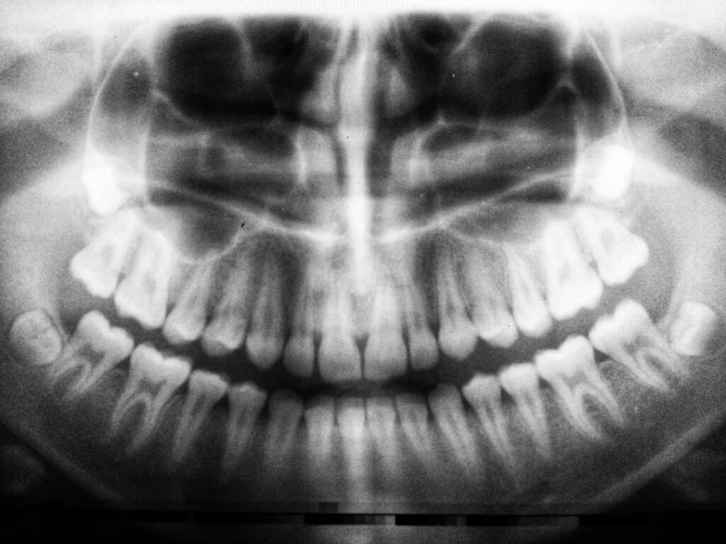 The Future of 3D Printing in Oral Healthcare Purley